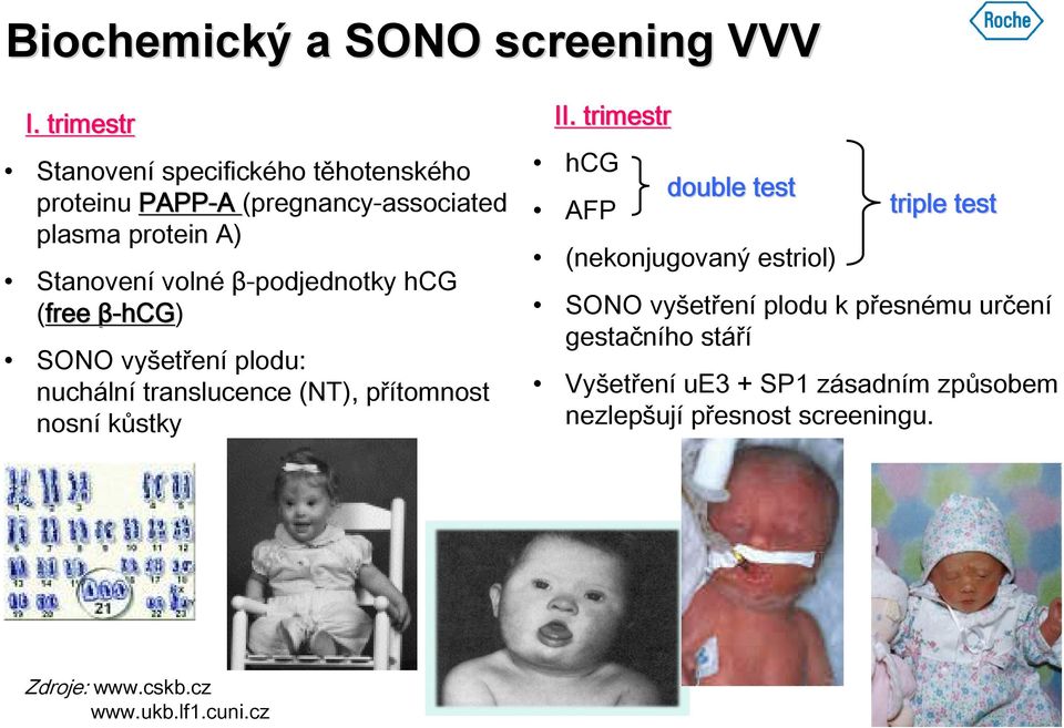 β-podjednotky hcg (free β-hcg) SONO vyšetření plodu: nuchální translucence (NT), přítomnost nosní kůstky II.