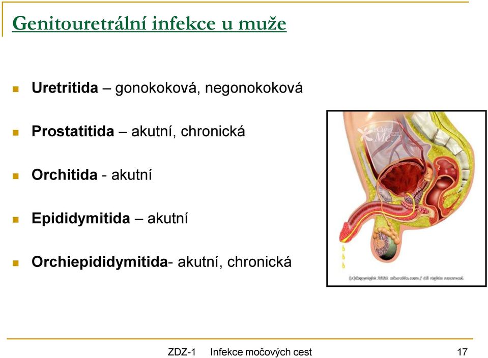 chronická Orchitida - akutní Epididymitida akutní