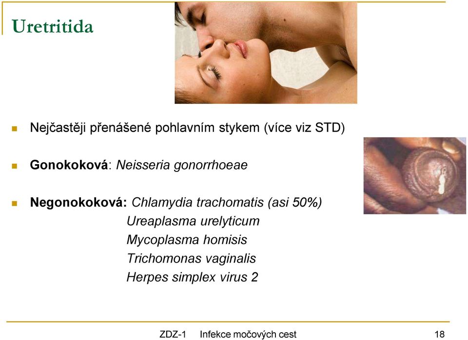 trachomatis (asi 50%) Ureaplasma urelyticum Mycoplasma homisis