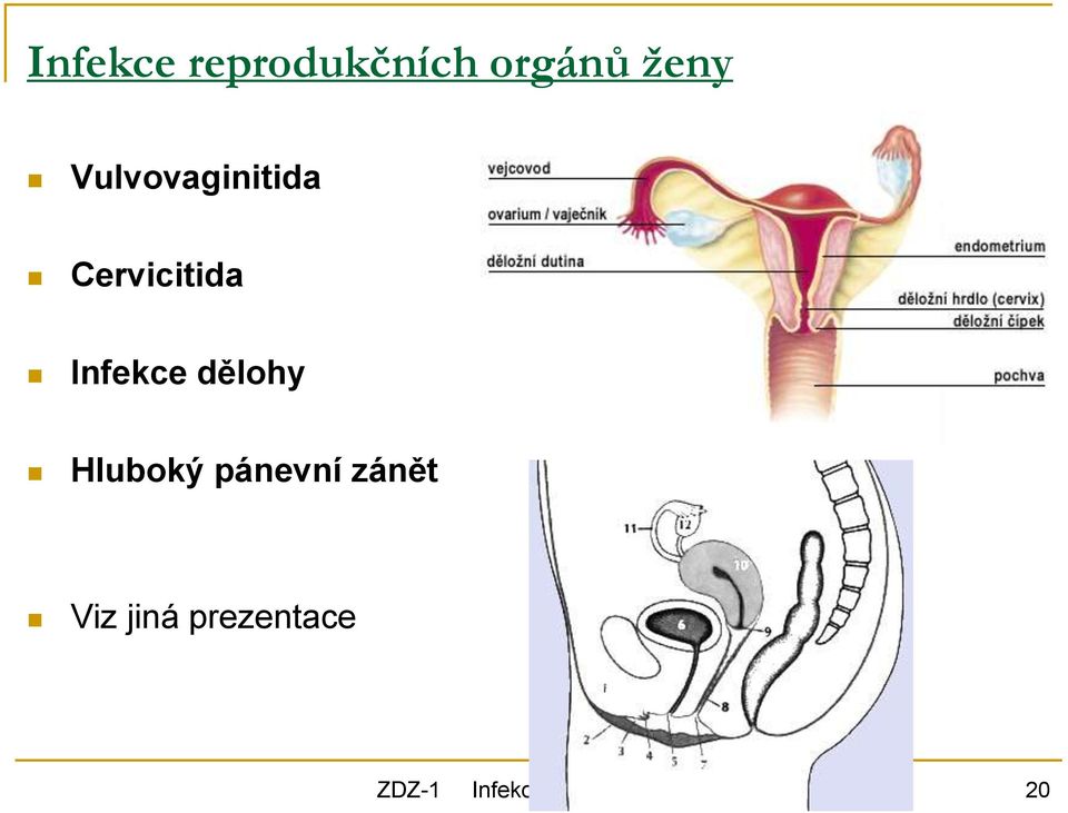 dělohy Hluboký pánevní zánět Viz jiná