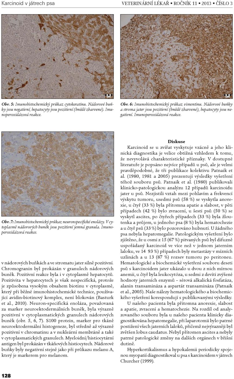 V cytoplasmì nádorových bunìk jsou pozitivní jemná granula. Imunoperoxidázová reakce. v nádorových buòkách a ve stromatu jater silnì pozitivní. Chromogranin byl prokázán v granulech nádorových bunìk.