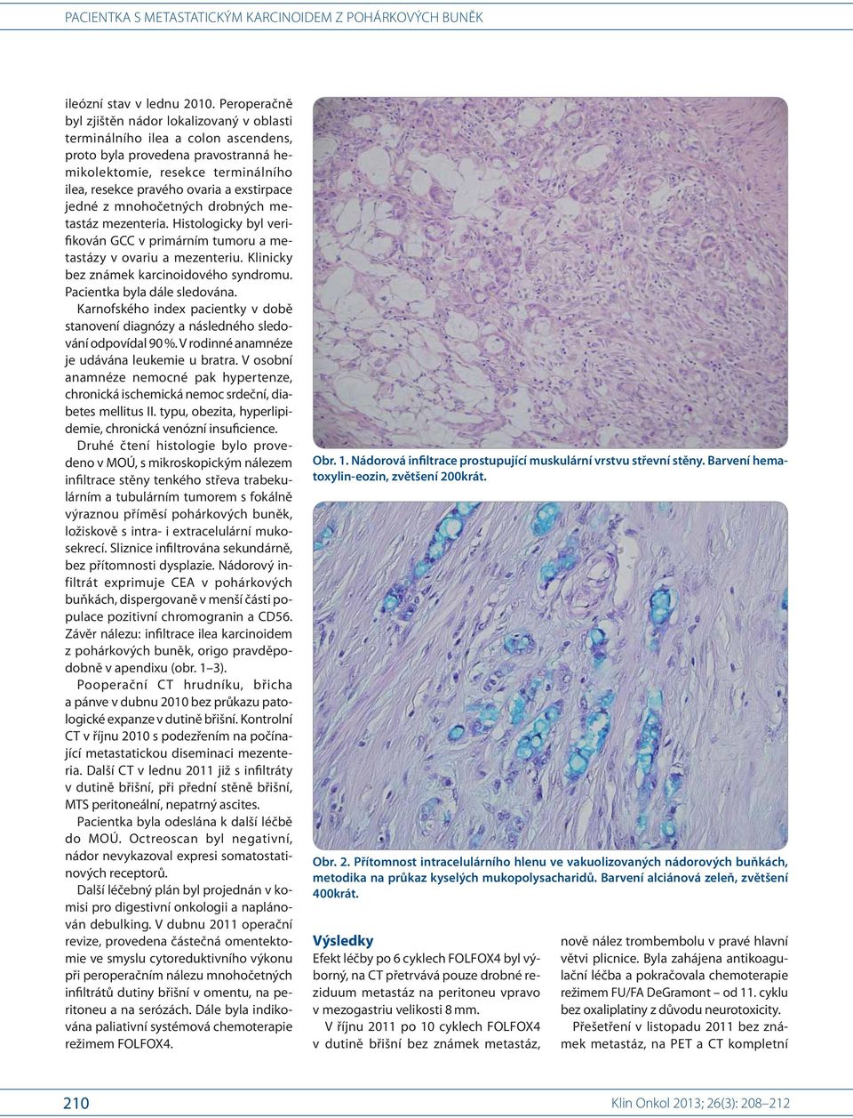 exstirpace jedné z mnohočetných drobných metastáz mezenteria. Histologicky byl verifikován GCC v primárním tumoru a metastázy v ovariu a mezenteriu. Klinicky bez známek karcinoidového syndromu.