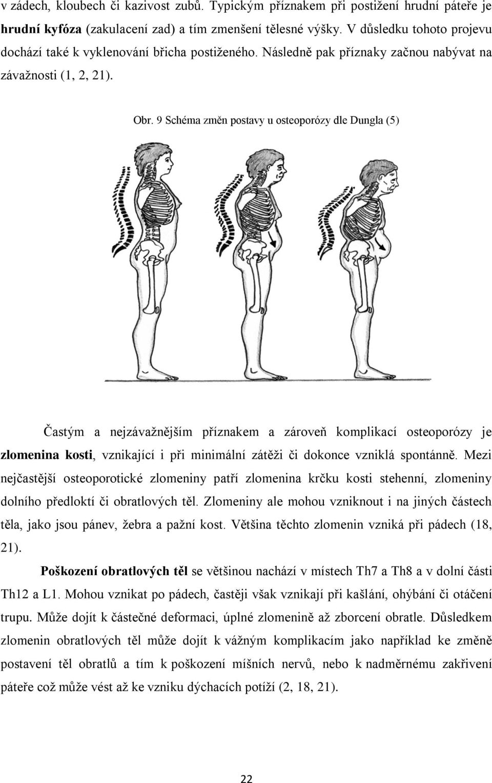 9 Schéma změn postavy u osteoporózy dle Dungla (5) Častým a nejzávaţnějším příznakem a zároveň komplikací osteoporózy je zlomenina kosti, vznikající i při minimální zátěţi či dokonce vzniklá