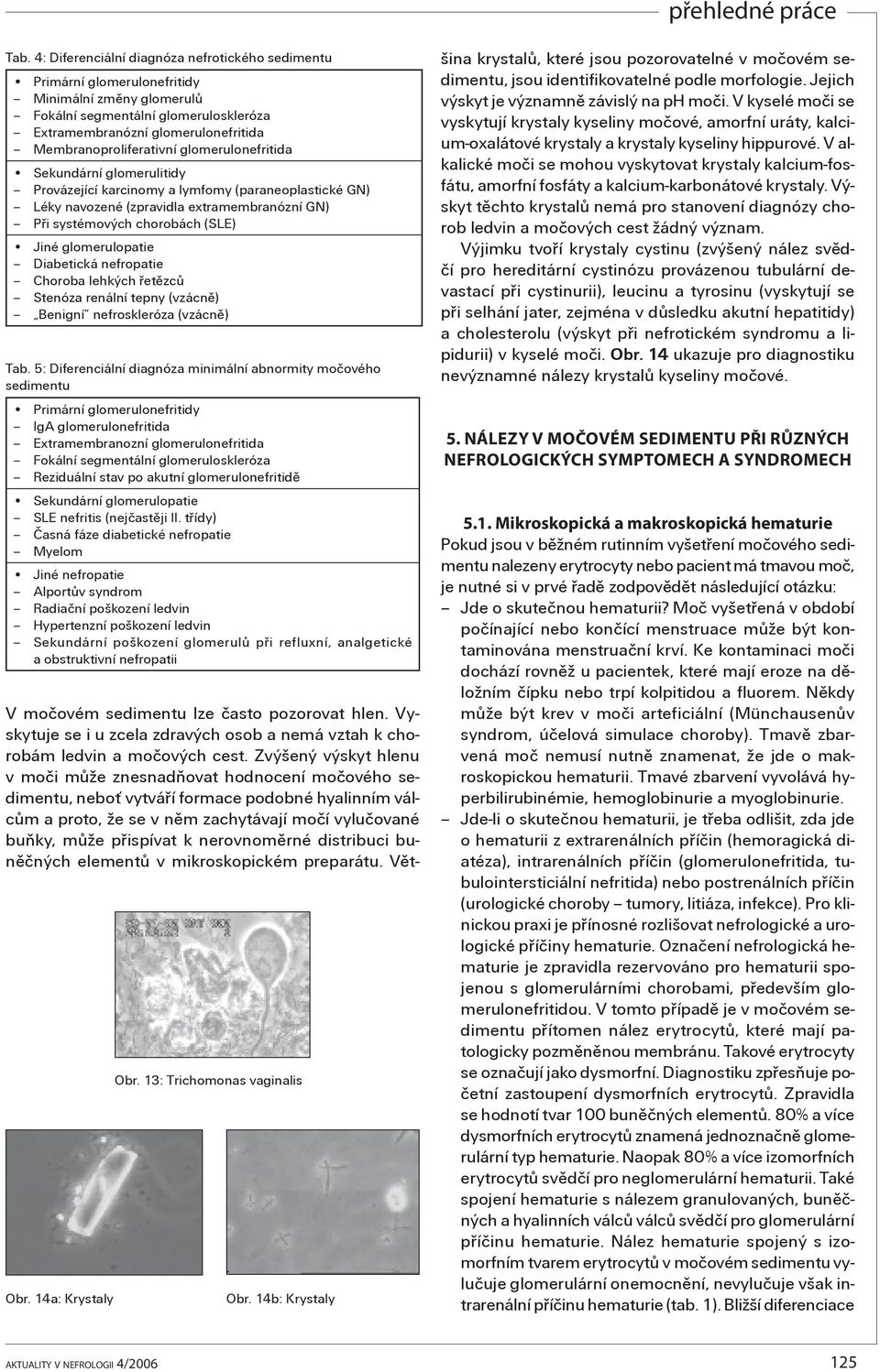 Jiné glomerulopatie Diabetická nefropatie Choroba lehkých øetìzcù Stenóza renální tepny (vzácnì) Benigní nefroskleróza (vzácnì) Tab.