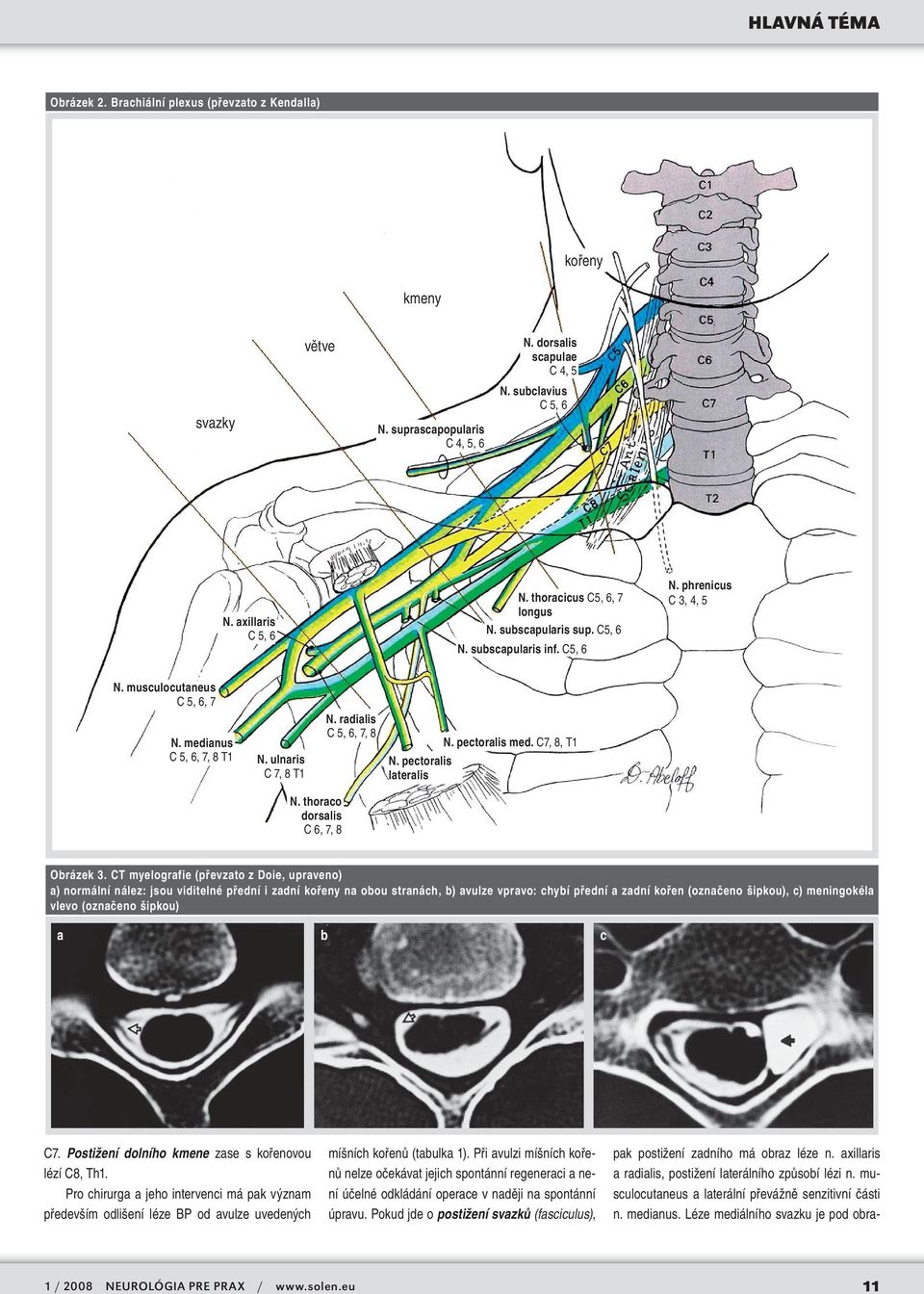 radialis C 5, 6, 7, 8 N. pectoralis med. C7, 8, T1 N. pectoralis lateralis N. thoraco dorsalis C 6, 7, 8 Obrázek 3.