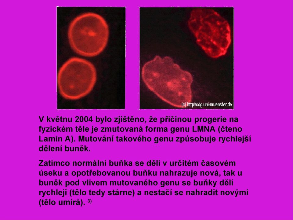 Zatímco normální buňka se dělí v určitém časovém úseku a opotřebovanou buňku nahrazuje nová, tak