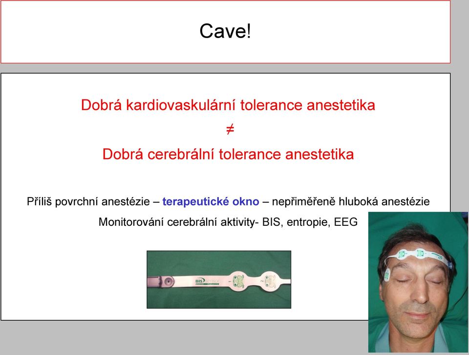 anestézie terapeutické okno nepřiměřeně hluboká