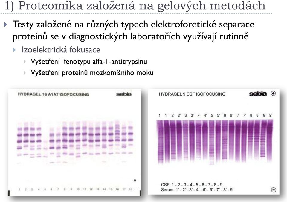 diagnostických laboratořích využívají rutinně Izoelektrická