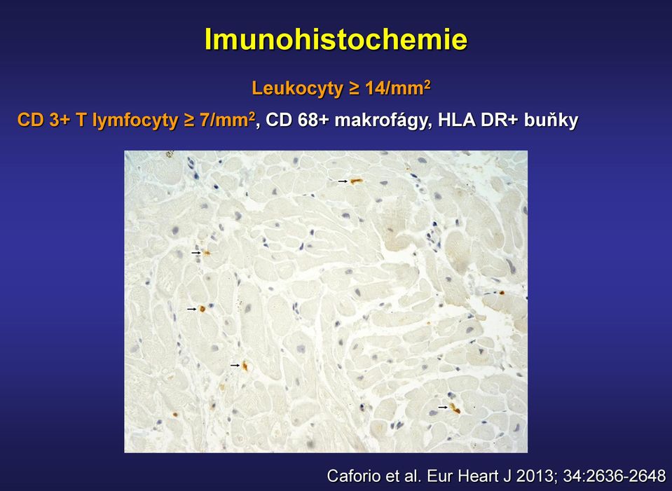 makrofágy, HLA DR+ buňky Caforio