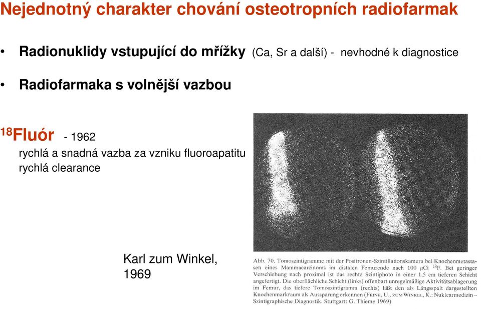 diagnostice Radiofarmaka s volnější vazbou 18 Fluór - 1962 rychlá