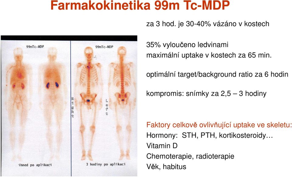 min. optimální target/background ratio za 6 hodin kompromis: snímky za 2,5 3 hodiny