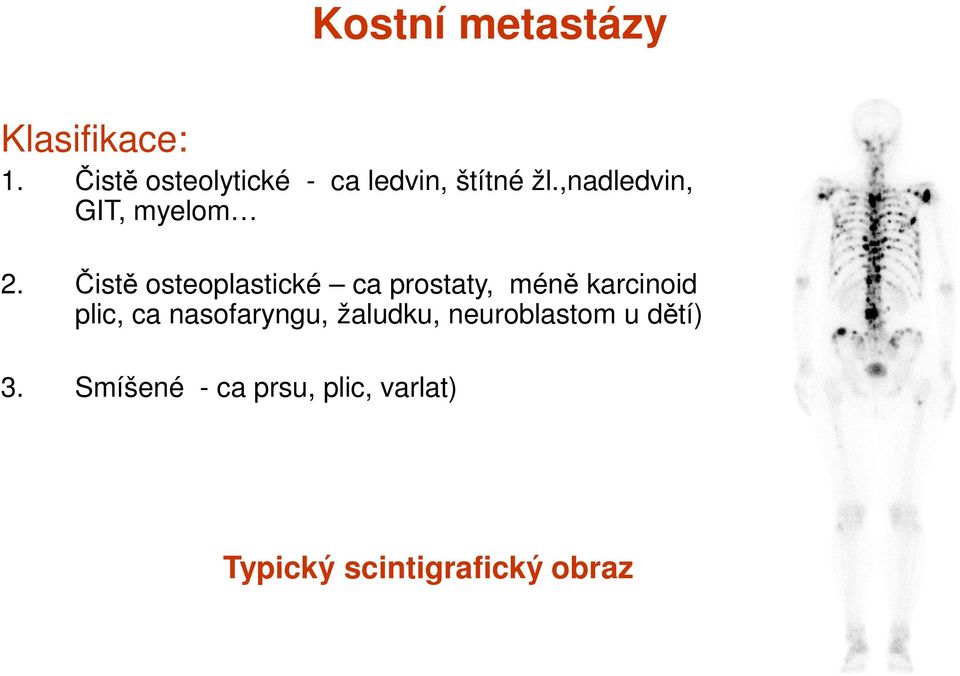 ,nadledvin, GIT, myelom 2.