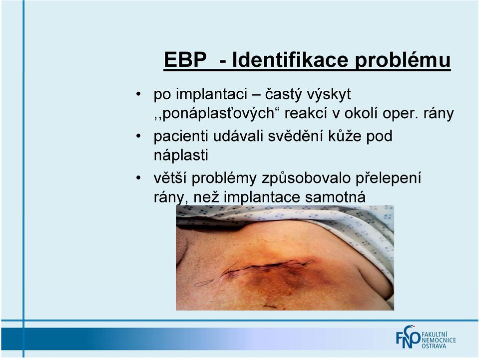 rány pacienti udávali svědění kůže pod náplasti