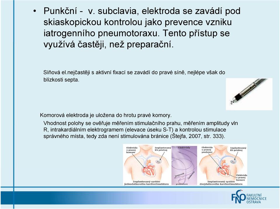 nejčastěji s aktivní fixací se zavádí do pravé síně, nejlépe však do blízkosti septa.