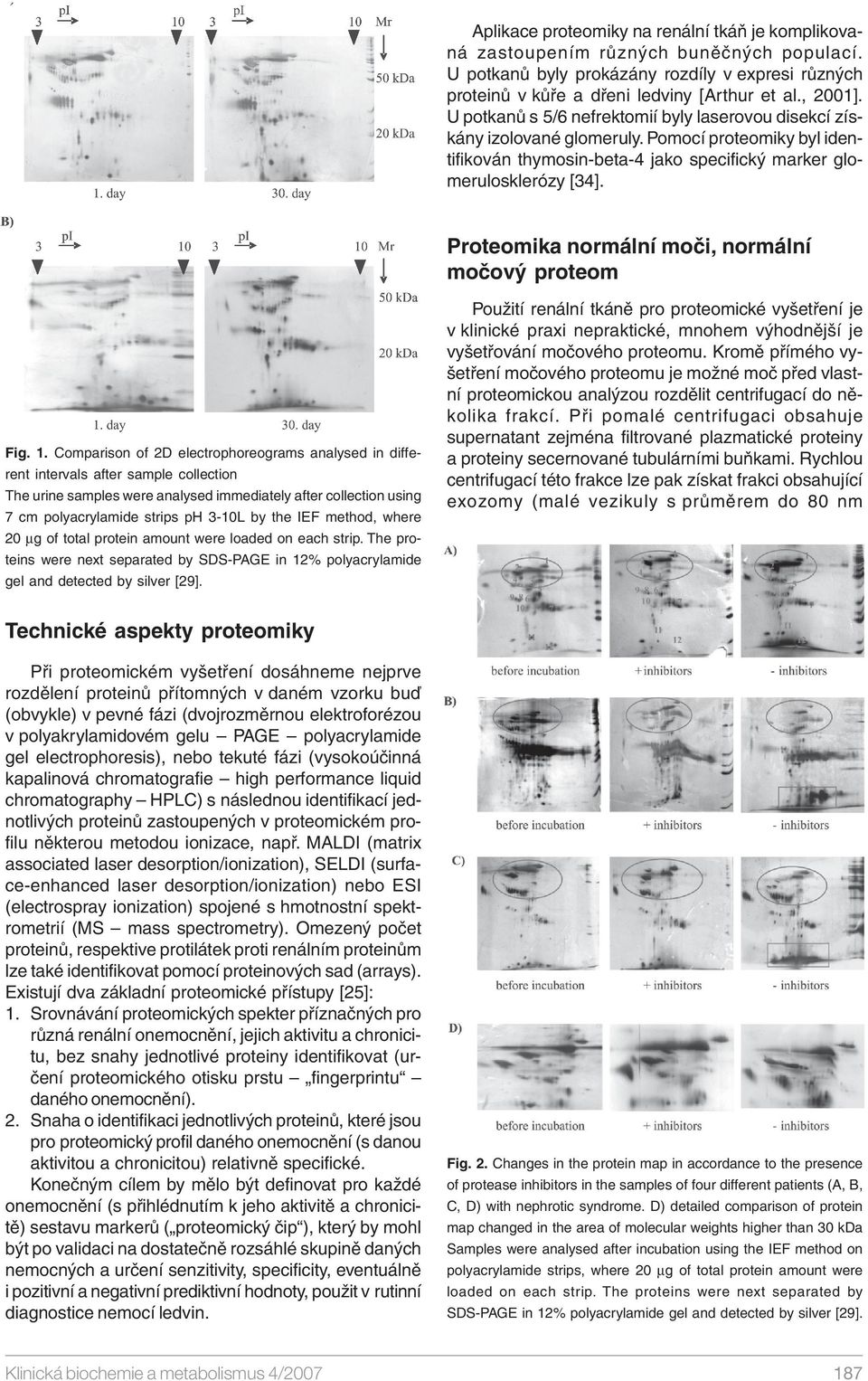 Proteomika normální moči, normální močový proteom Fig. 1.