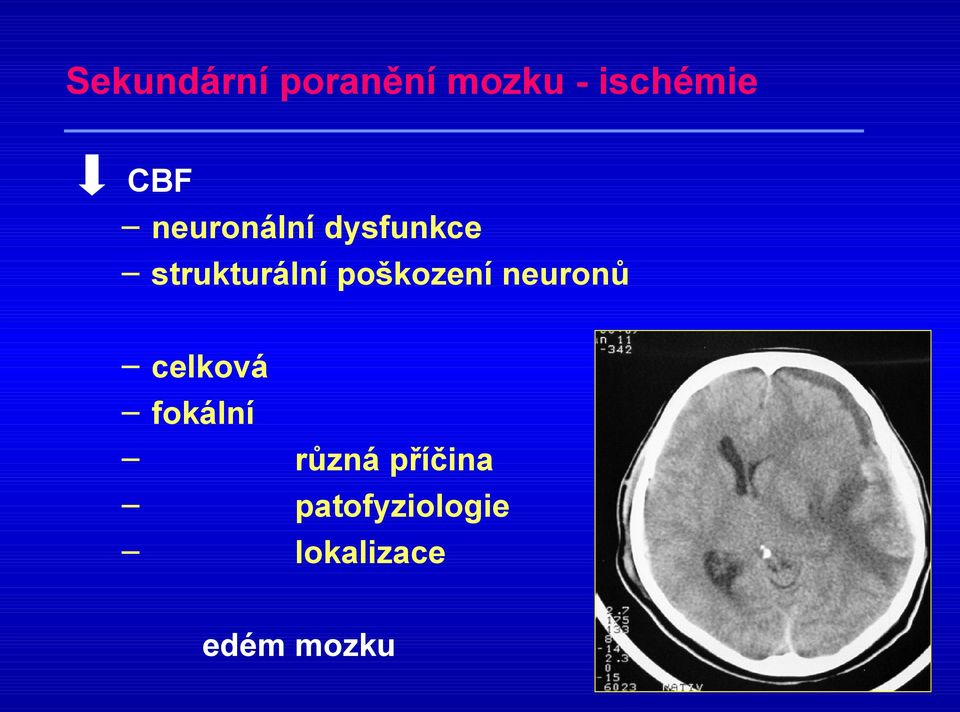 poškození neuronů celková fokální různá