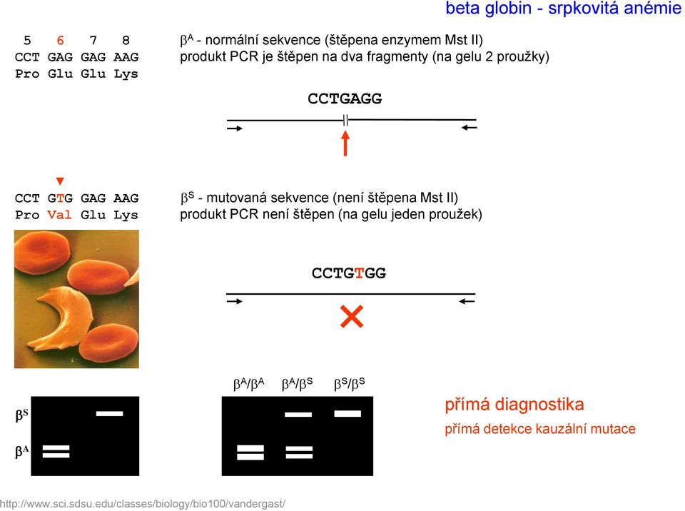 mutovaná sekvence (není štěpena Mst II) produkt PCR není štěpen (na gelu jeden proužek) CCTGTGG b S b A /b A b A /b