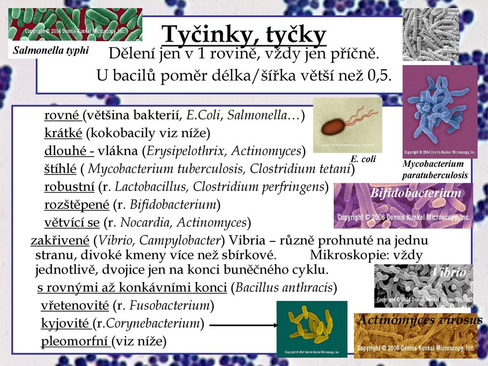 Lactobacillus, Clostridium perfringens) rozštěpené (r. Bifidobacterium) větvící se (r. Nocardia, Actinomyces) E.