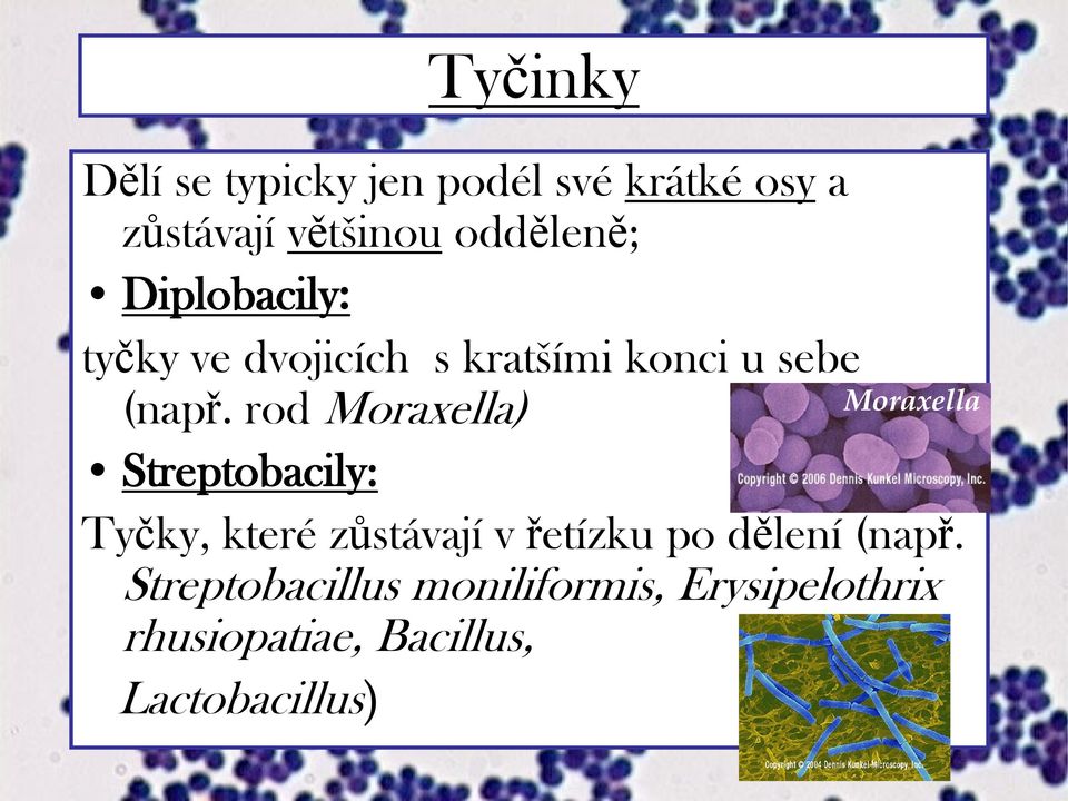rod Moraxella) Streptobacily: Tyčky, které zůstávají v řetízku po dělení (např.