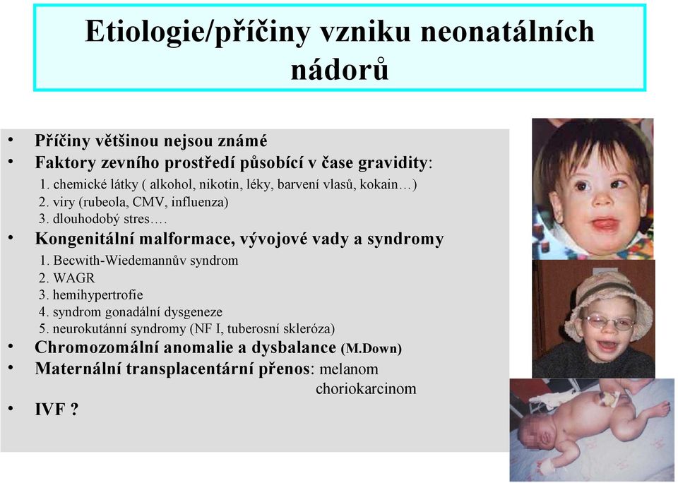 Kongenitální malformace, vývojové vady a syndromy 1. Becwith-Wiedemannův syndrom 2. WAGR 3. hemihypertrofie 4.