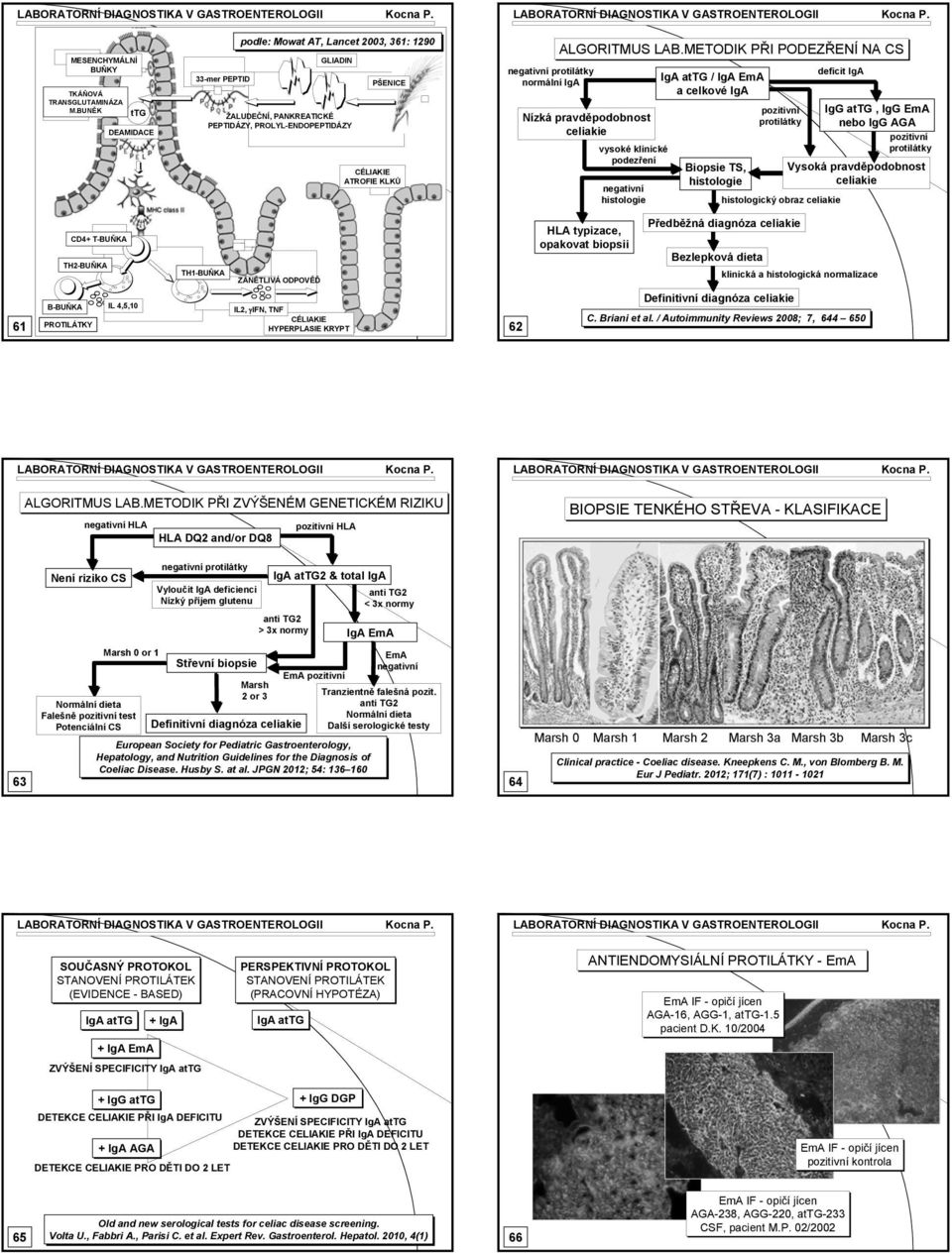 IgA ALGORITMUS LAB.