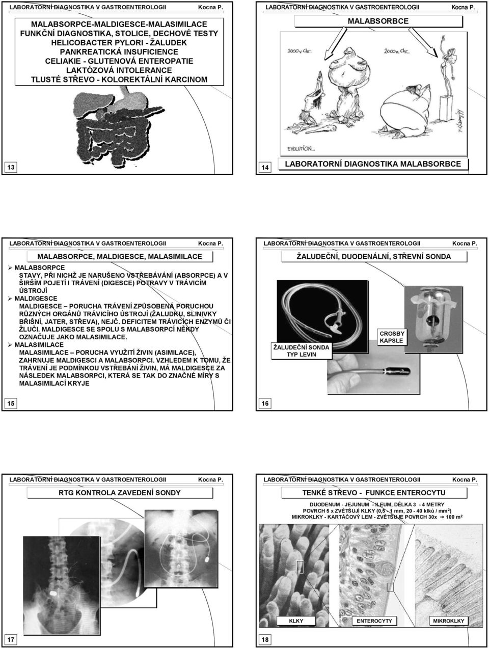 ÚSTROJÍ MALDIGESCE MALDIGESCE PORUCA TRÁVENÍ ZPŮSOBENÁ PORUCOU RŮZNÝC ORGÁNŮ TRÁVICÍO ÚSTROJÍ (ŽALUDKU, SLINIVKY BŘIŠNÍ, JATER, STŘEVA), NEJČ. DEFICITEM TRÁVICÍC ENZYMŮ ČI ŽLUČI.