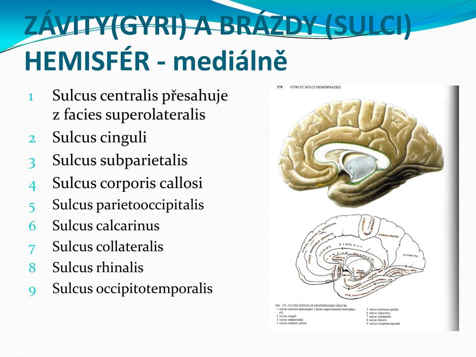subparietalis 4 Sulcus corporis callosi 5 Sulcus parietooccipitalis 6
