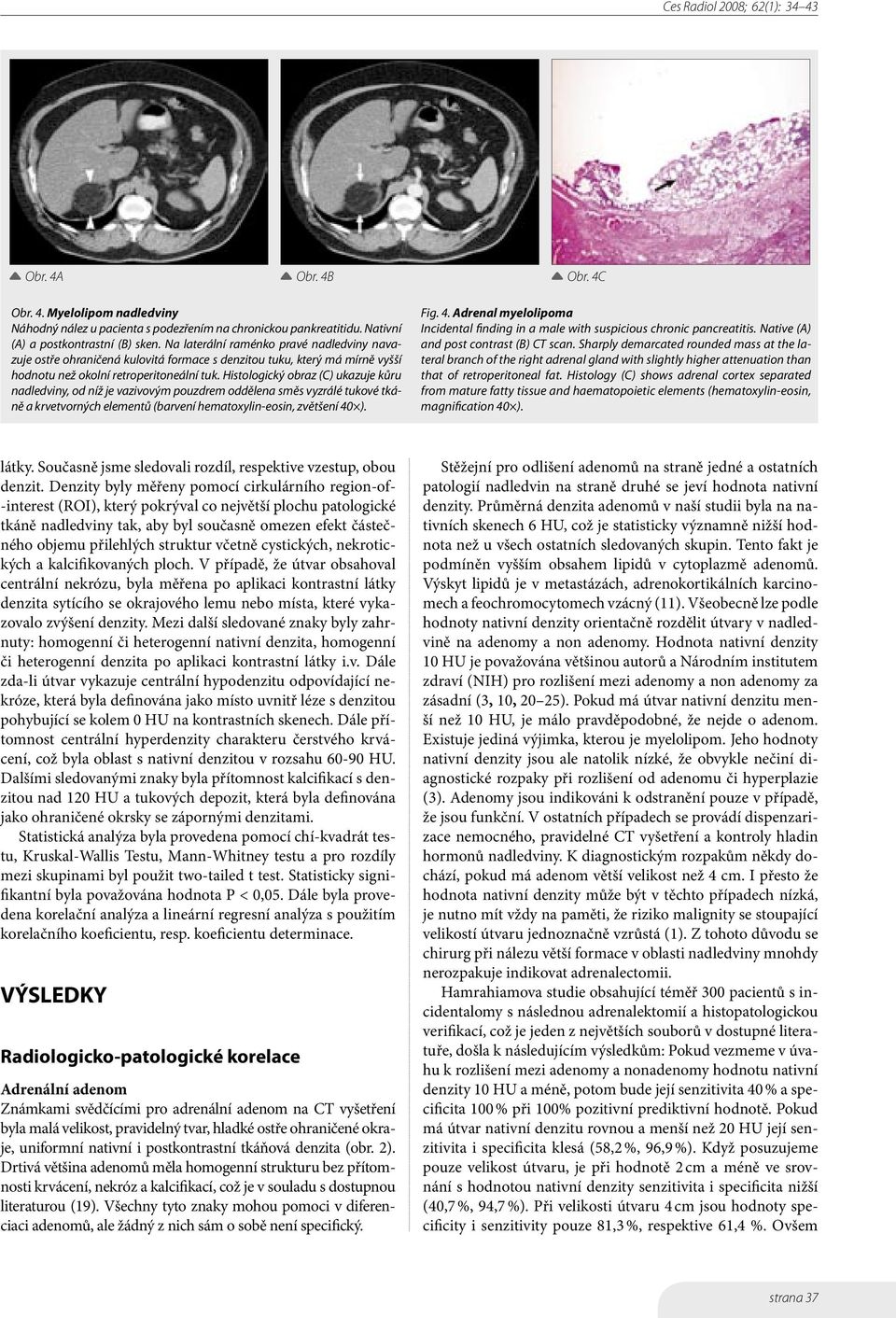 Histologický obraz (C) ukazuje kůru nadledviny, od níž je vazivovým pouzdrem oddělena směs vyzrálé tukové tkáně a krvetvorných elementů (barvení hematoxylin-eosin, zvětšení 40