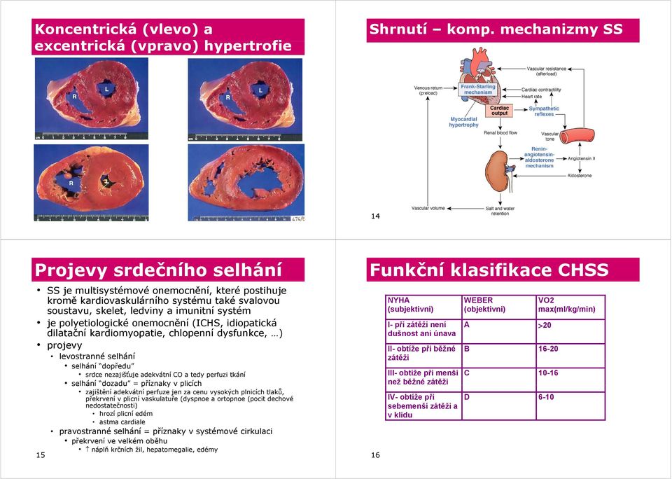 polyetiologické onemocnění (ICHS, idiopatická dilatační kardiomyopatie, chlopenní dysfunkce, ) projevy levostranné selhání 15 selhání dopředu srdce nezajišťuje adekvátní CO a tedy perfuzi tkání