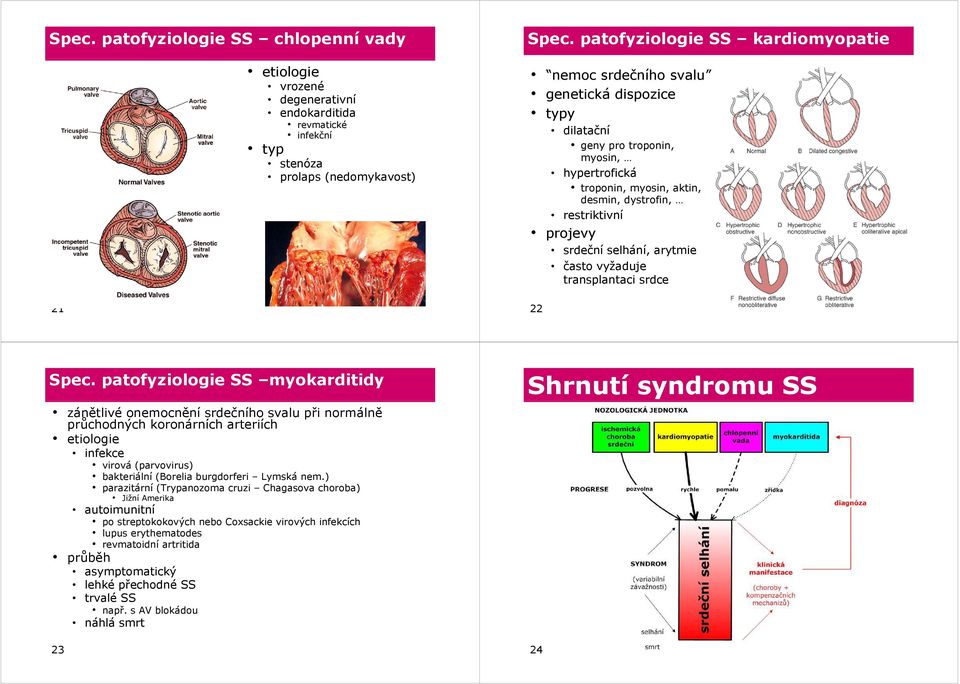 srdeční č selhání, arytmie často vyžaduje transplantaci a ac srdce 22 Spec.