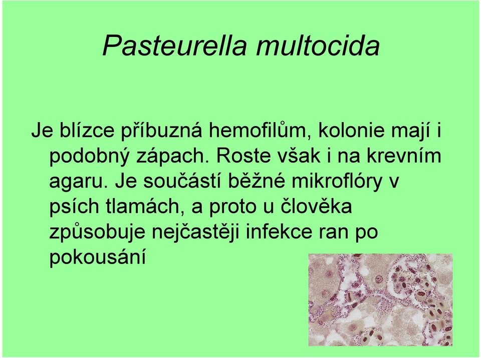 Roste však i na krevním agaru.