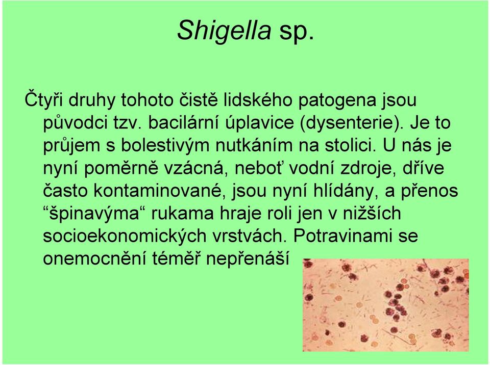 U nás je nyní poměrně vzácná, neboť vodní zdroje, dříve často kontaminované, jsou nyní