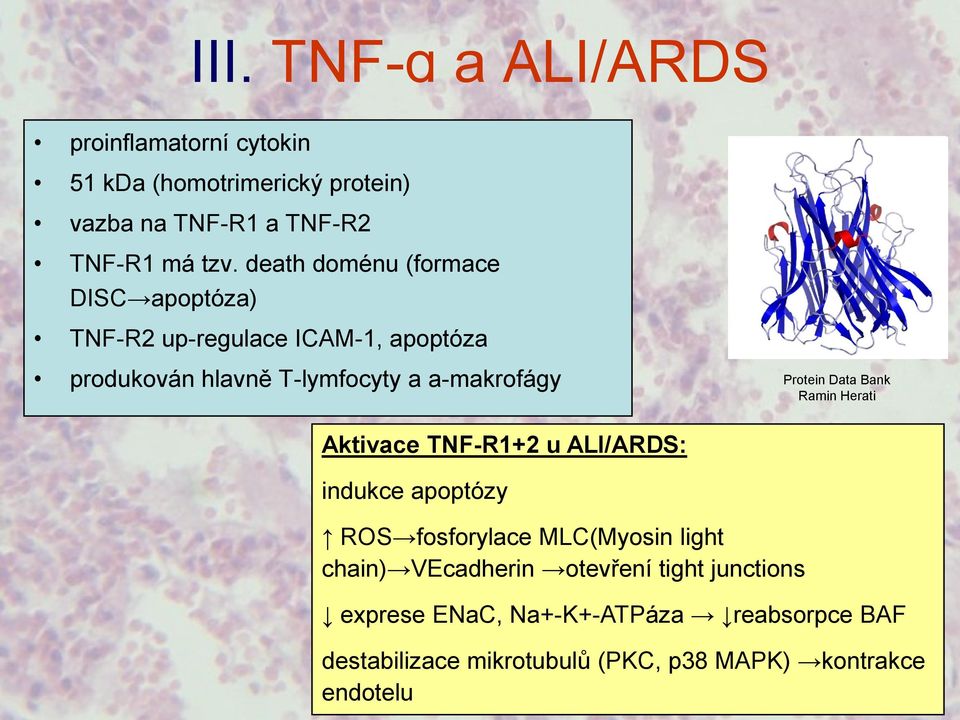 Protein Data Bank Ramin Herati Aktivace TNF-R1+2 u ALI/ARDS: indukce apoptózy ROS fosforylace MLC(Myosin light chain)