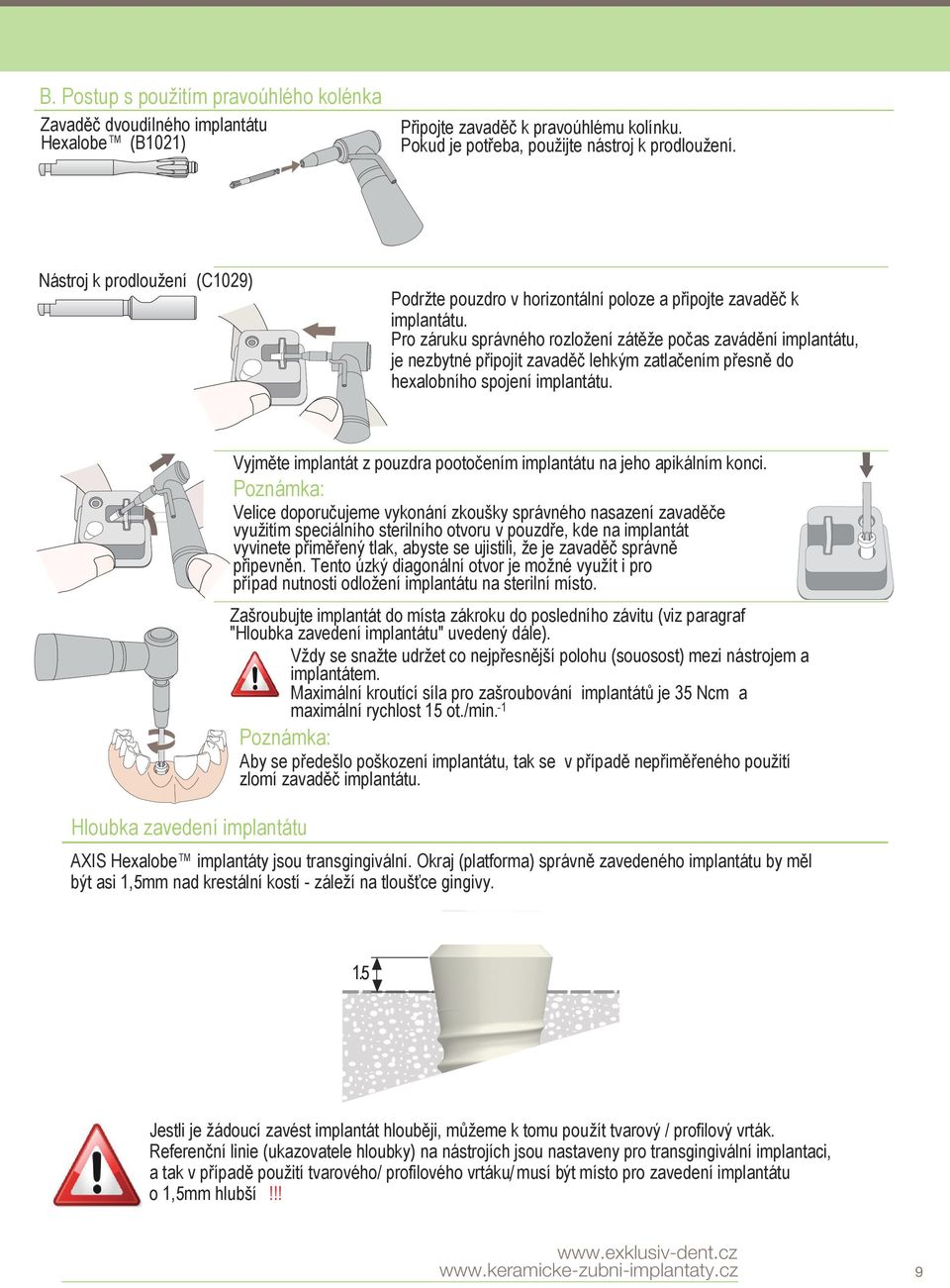 Pro záruku správného rozložení zátěže počas zavádění implantátu, je nezbytné připojit zavaděč lehkým zatlačením přesně do hexalobního spojení implantátu.