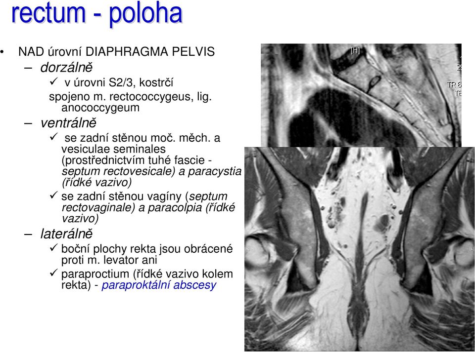 a vesiculae seminales (prostřednictvím tuhé fascie - septum rectovesicale) a paracystia (řídké vazivo) se zadní