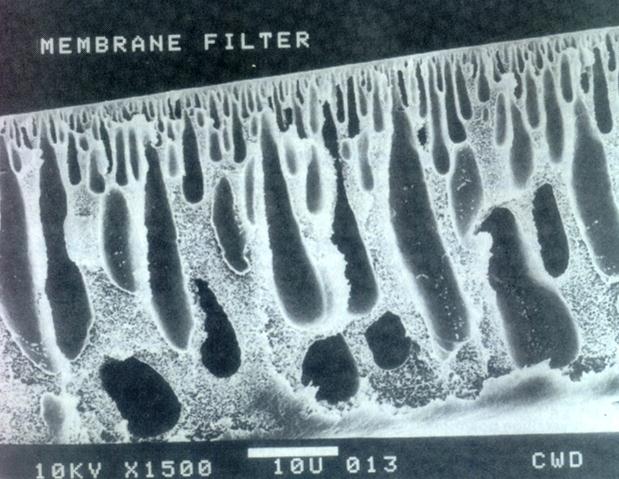 2. Asymetrické (s aktivní vrstvou) na povrchu nosiče je nanesena tenká aktivní vrstva, na které dochází k filtraci, s malou velikostí pórů,