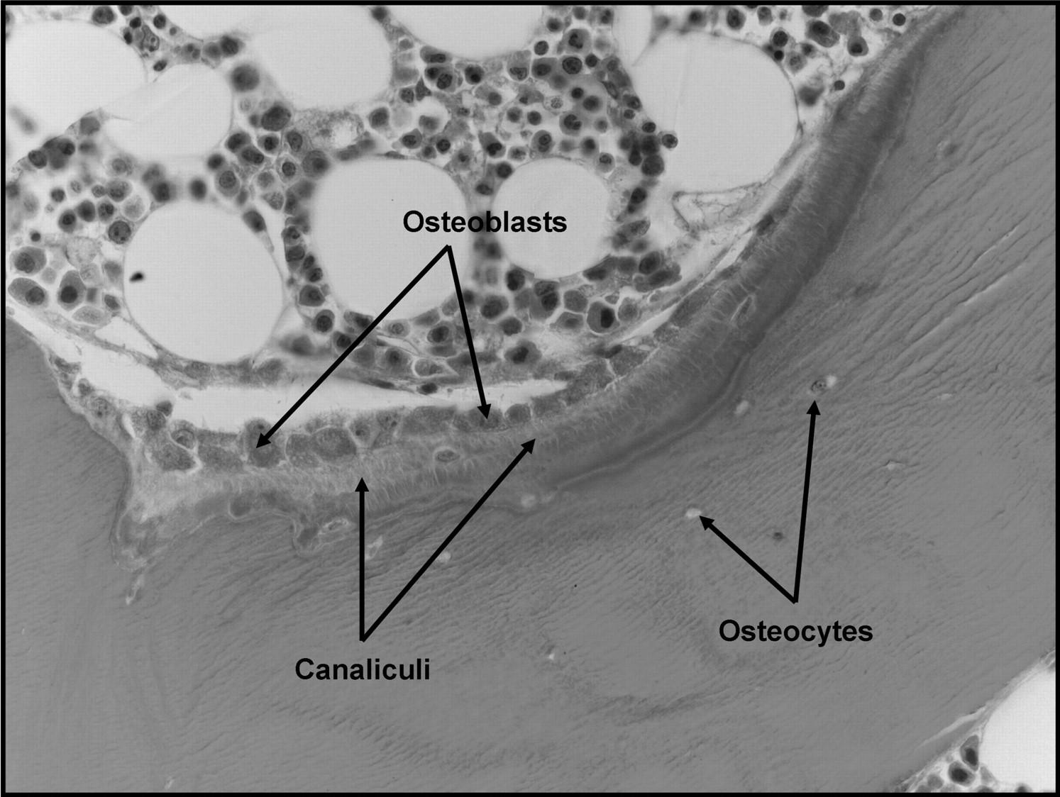 Osteoblasty syntetizují matrix, tvořenou hlavně kolagenem I collagen a zaplňují
