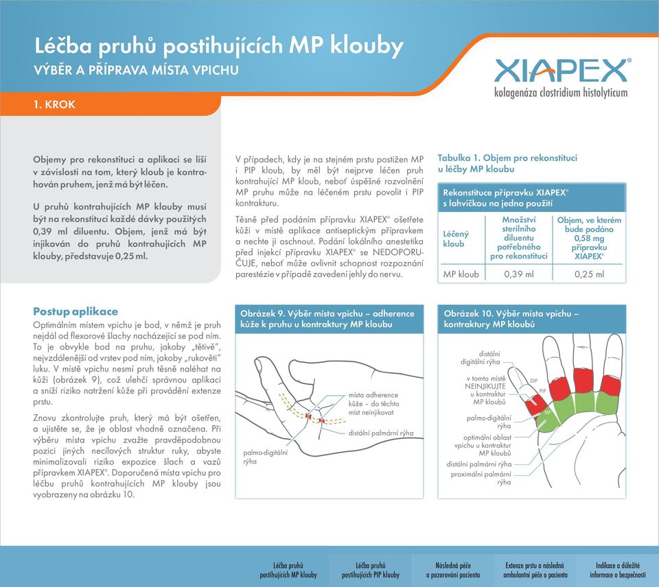 V případech, kdy je na stejném prstu postižen MP i PIP kloub, by měl být nejprve léčen pruh kontrahující MP kloub, neboť úspěšné rozvolnění MP pruhu může na léčeném prstu povolit i PIP kontrakturu.