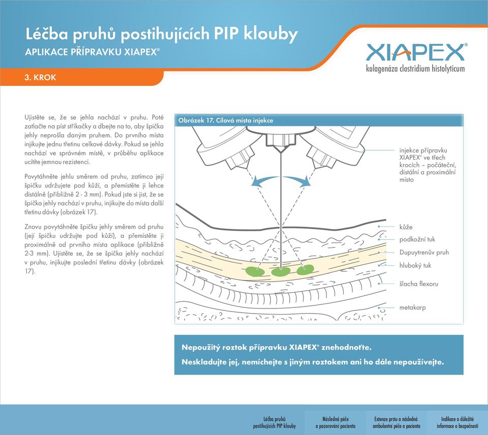 Povytáhněte jehlu směrem od pruhu, zatímco její špičku udržujete pod kůží, a přemístěte ji lehce distálně (přibližně 2-3 mm).