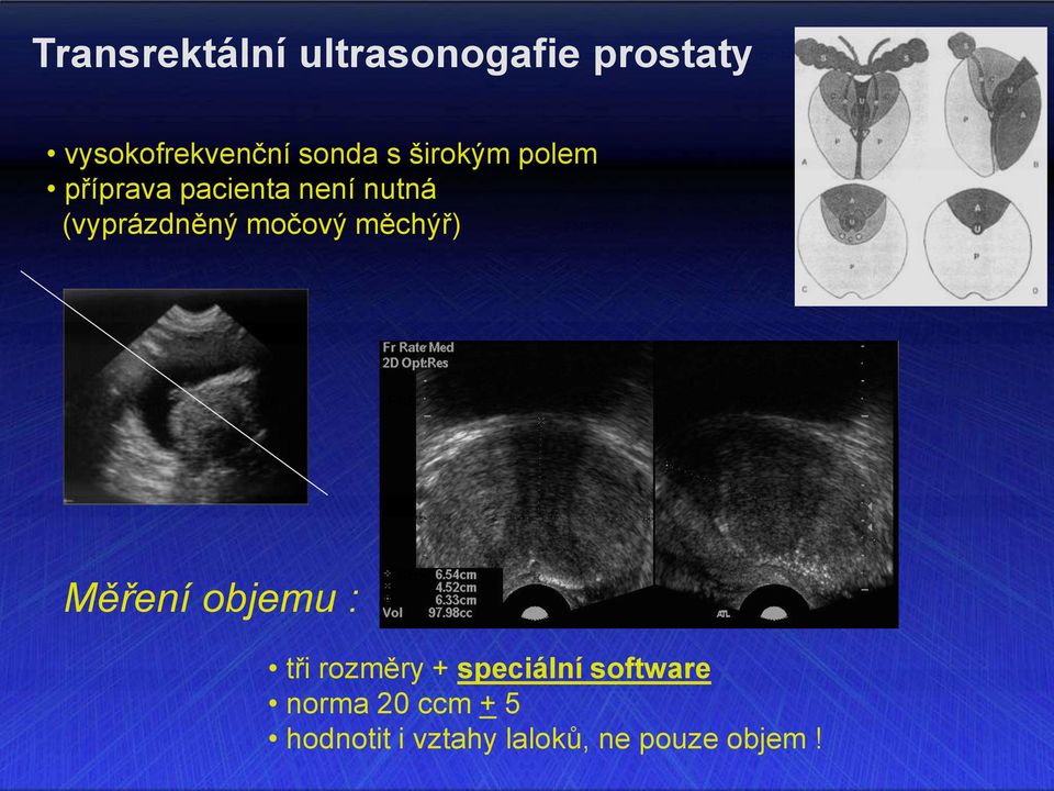 močový měchýř) Měření objemu : tři rozměry + speciální