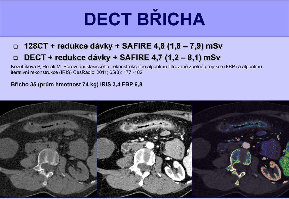 Porovnání klasického rekonstrukčního algoritmu filtrované zpětné projekce (FBP) a
