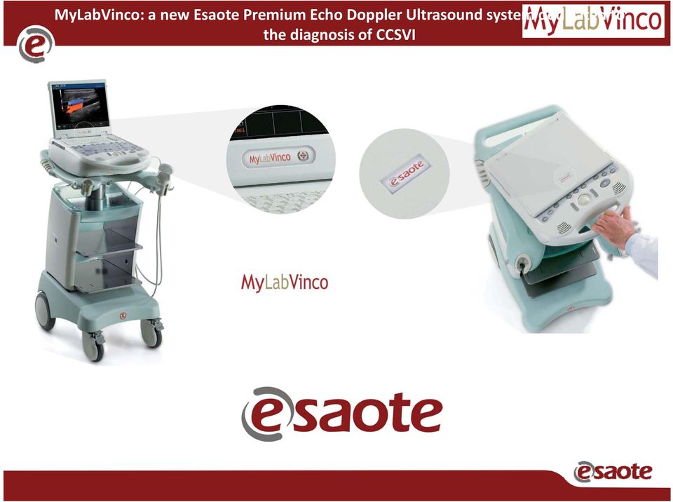 Ultrasound system