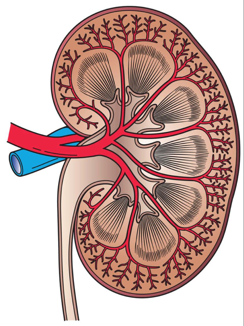 Ateroskleróza Renovaskulární choroba Ateroembolická choroba Arteriální