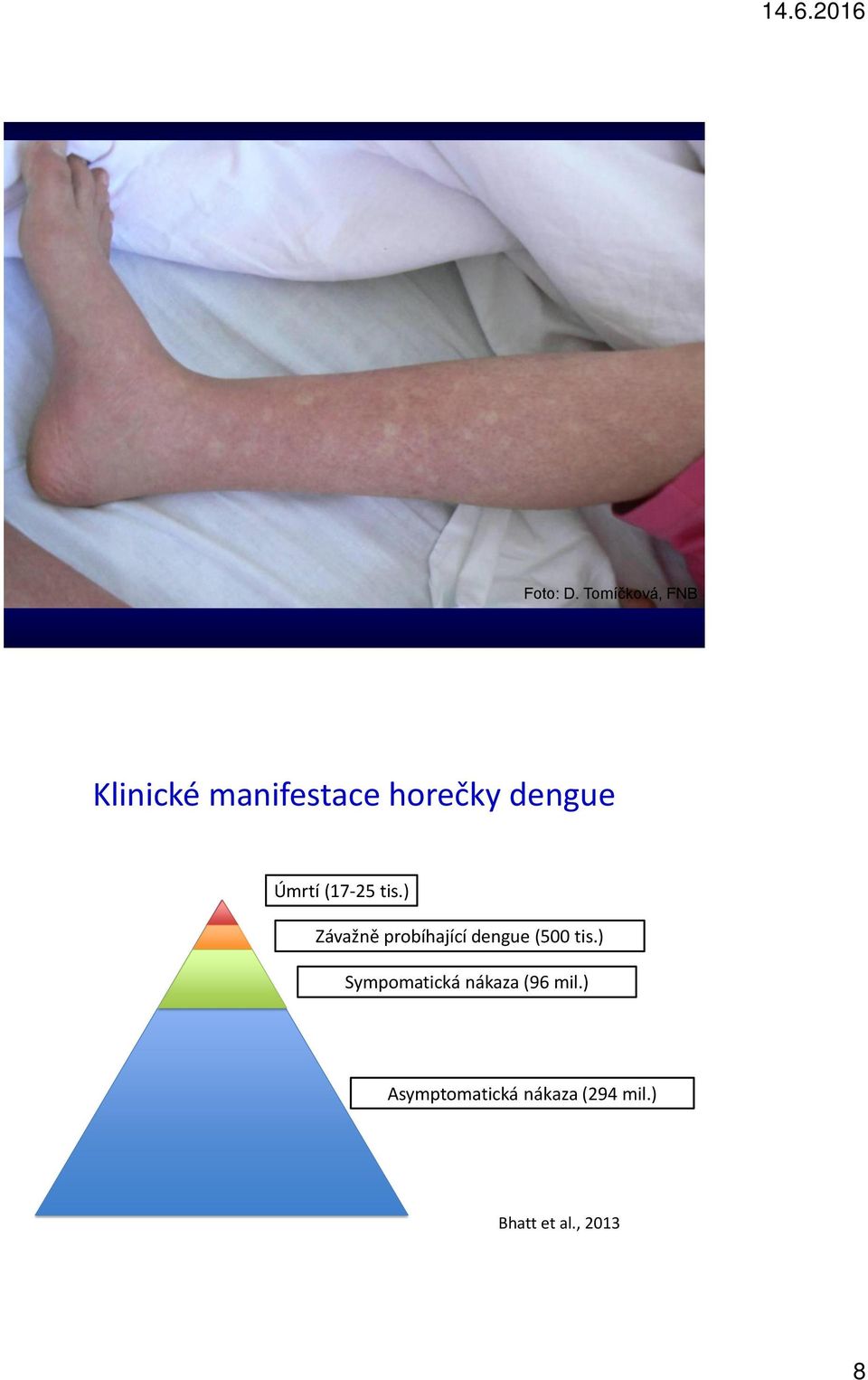dengue Úmrtí (17-25 tis.