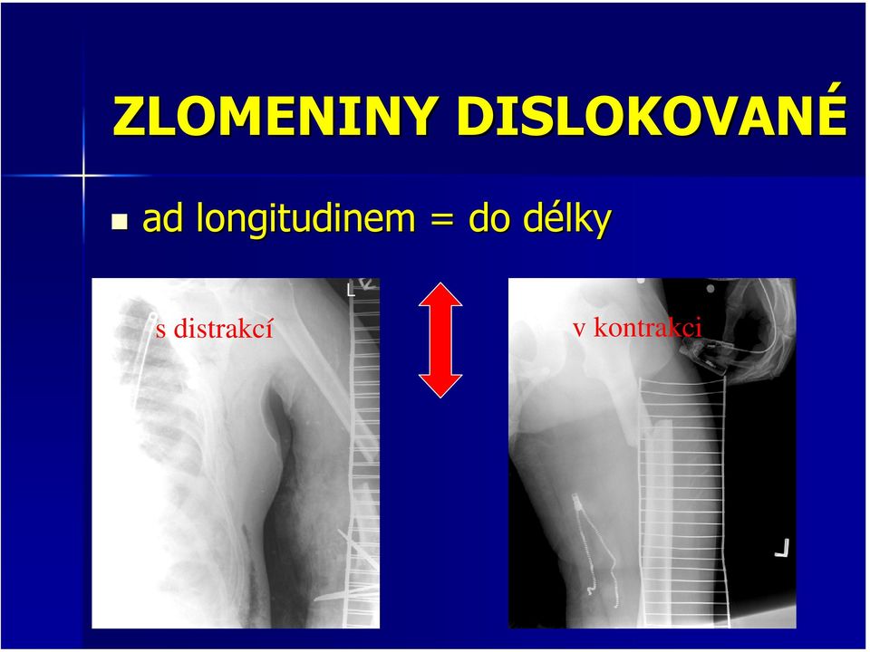 longitudinem = do