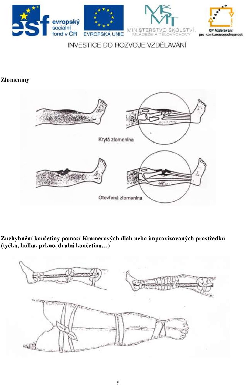 improvizovaných prostředků