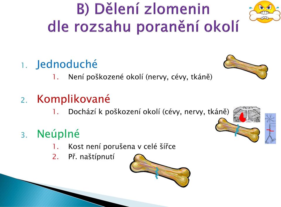 Komplikované 3. Neúplné 1.