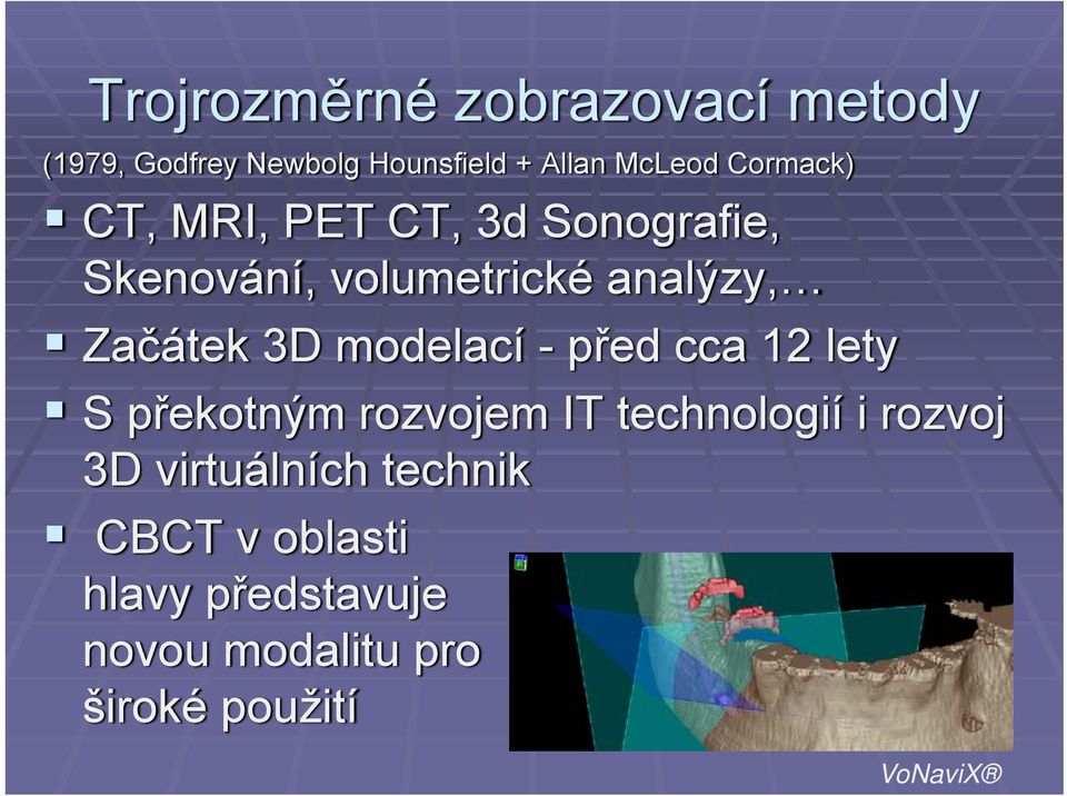 3D modelací - před cca 12 lety S překotným rozvojem IT technologií i rozvoj 3D