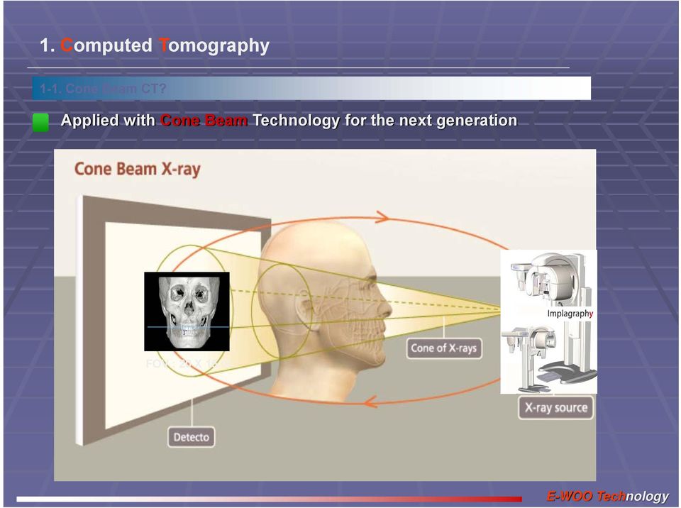 Applied with Cone Beam Technology