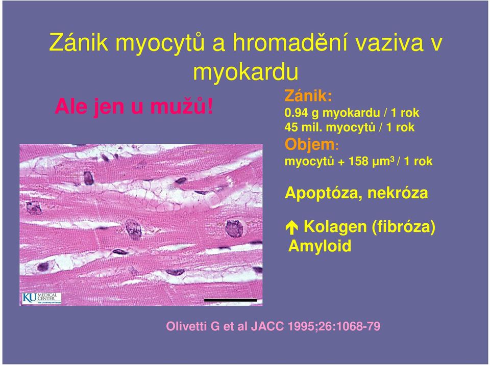 myocytů / 1 rok Objem: myocytů + 158 µm 3 / 1 rok